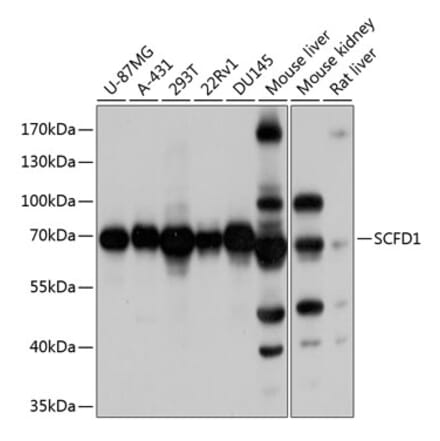 Western Blot - Anti-Sly1 Antibody (A16272) - Antibodies.com