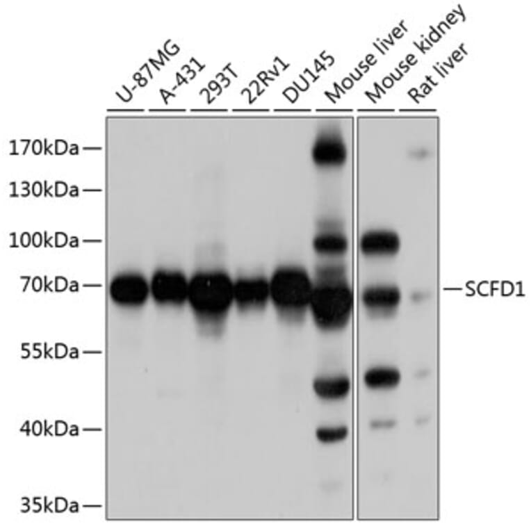 Western Blot - Anti-Sly1 Antibody (A16272) - Antibodies.com