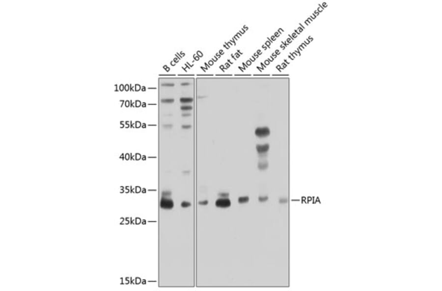 Western Blot - Anti-RPIA/PRI Antibody (A16273) - Antibodies.com