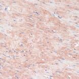 Immunohistochemistry - Anti-RPIA/PRI Antibody (A16273) - Antibodies.com