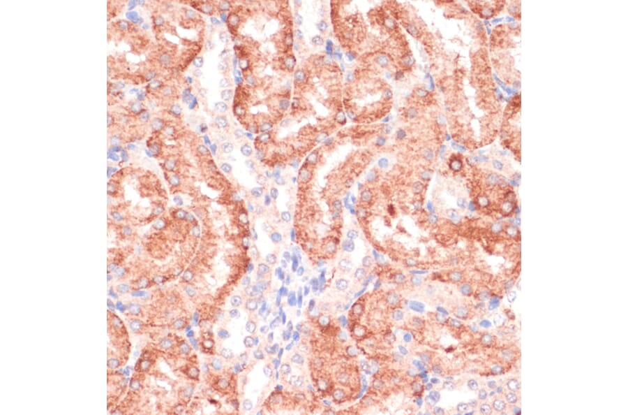 Immunohistochemistry - Anti-RPIA/PRI Antibody (A16273) - Antibodies.com