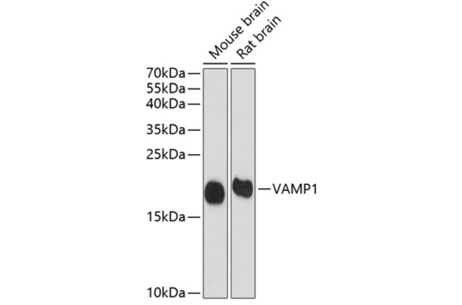 Western Blot - Anti-VAMP1 Antibody (A16275) - Antibodies.com