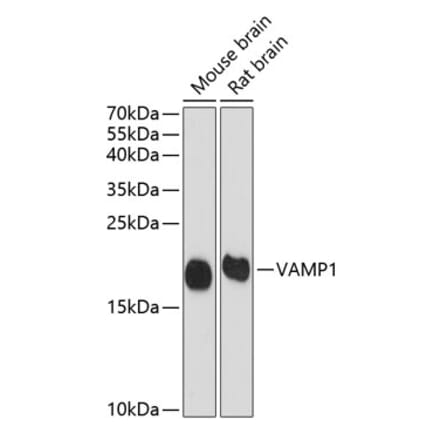 Western Blot - Anti-VAMP1 Antibody (A16275) - Antibodies.com