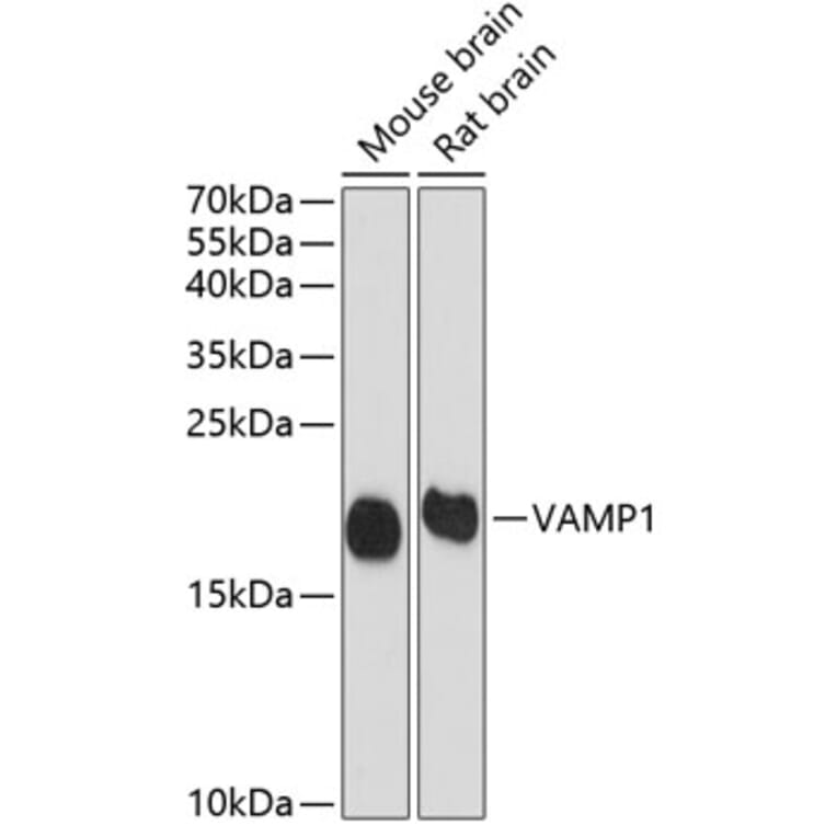 Western Blot - Anti-VAMP1 Antibody (A16275) - Antibodies.com