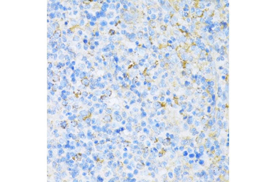 Immunohistochemistry - Anti-VAMP1 Antibody (A16275) - Antibodies.com