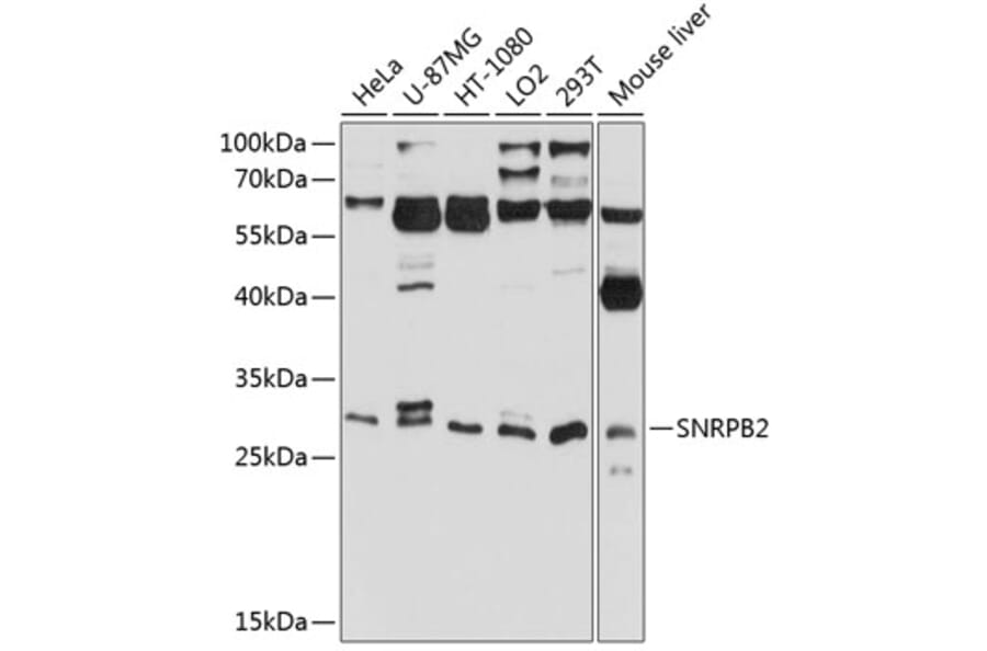 Western Blot - Anti-SNRPB2 Antibody (A16276) - Antibodies.com