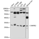 Western Blot - Anti-SNRPB2 Antibody (A16276) - Antibodies.com