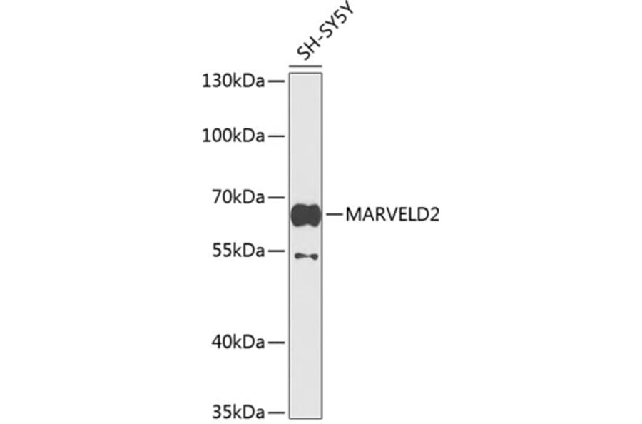Western Blot - Anti-MARVELD2/Tricellulin Antibody (A16277) - Antibodies.com