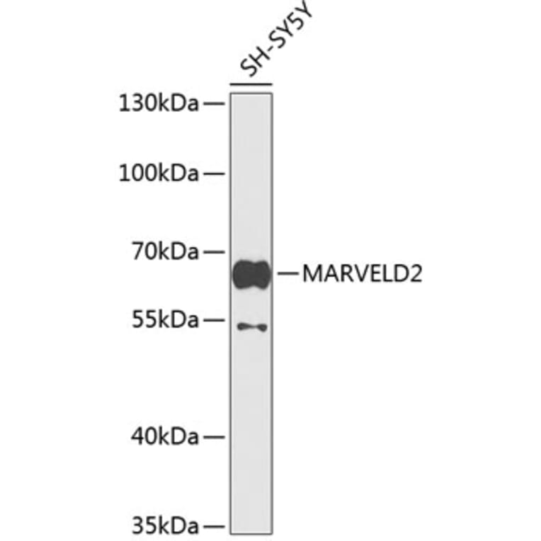 Western Blot - Anti-MARVELD2/Tricellulin Antibody (A16277) - Antibodies.com