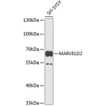 Western Blot - Anti-MARVELD2/Tricellulin Antibody (A16277) - Antibodies.com