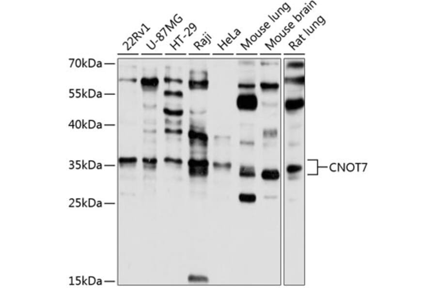 Western Blot - Anti-CNOT7 Antibody (A16278) - Antibodies.com