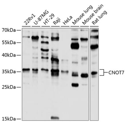 Western Blot - Anti-CNOT7 Antibody (A16278) - Antibodies.com