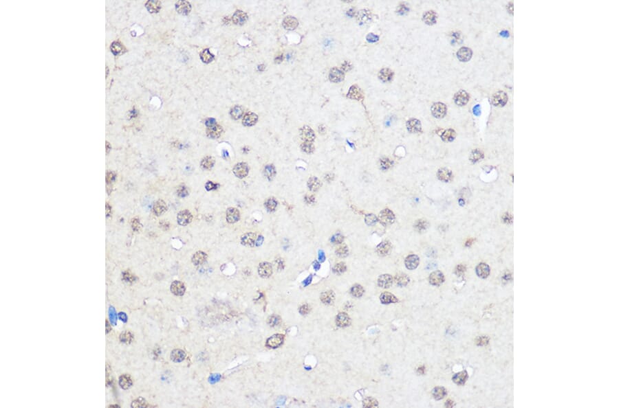 Immunohistochemistry - Anti-CNOT7 Antibody (A16278) - Antibodies.com