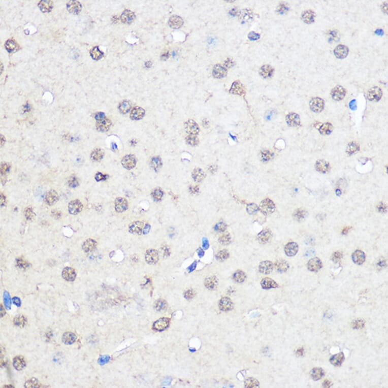Immunohistochemistry - Anti-CNOT7 Antibody (A16278) - Antibodies.com