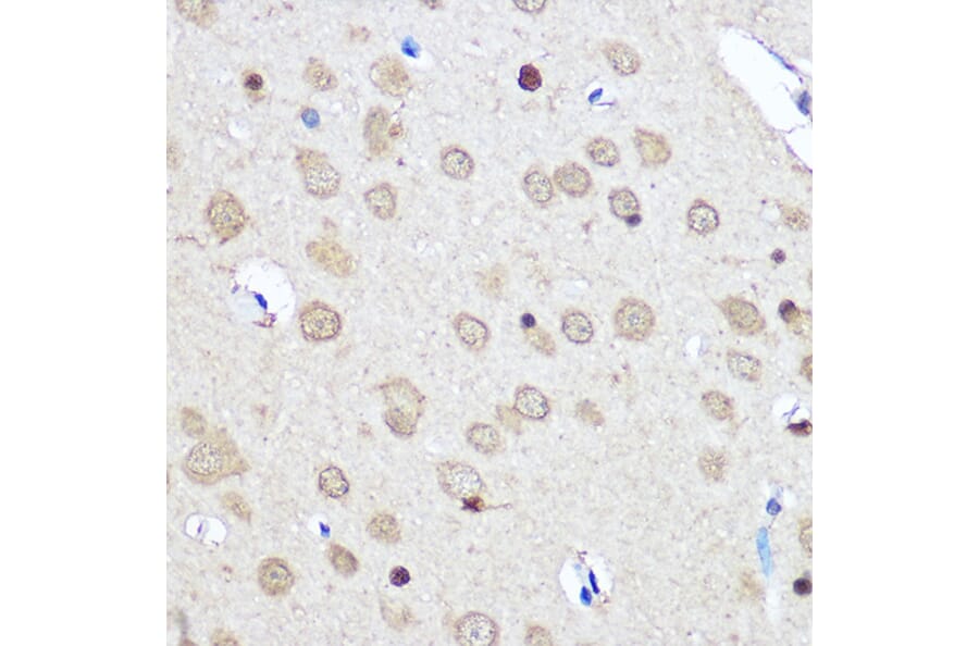 Immunohistochemistry - Anti-CNOT7 Antibody (A16278) - Antibodies.com