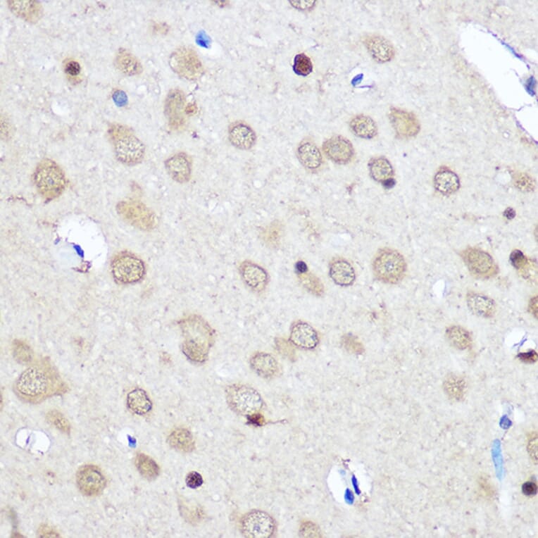 Immunohistochemistry - Anti-CNOT7 Antibody (A16278) - Antibodies.com