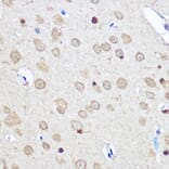 Immunohistochemistry - Anti-CNOT7 Antibody (A16278) - Antibodies.com