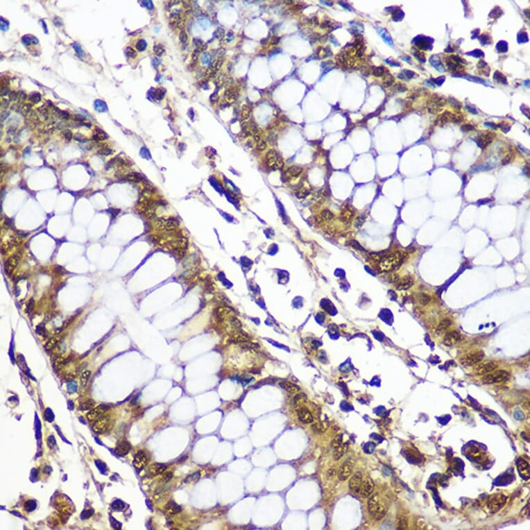 Immunohistochemistry - Anti-CNOT7 Antibody (A16278) - Antibodies.com