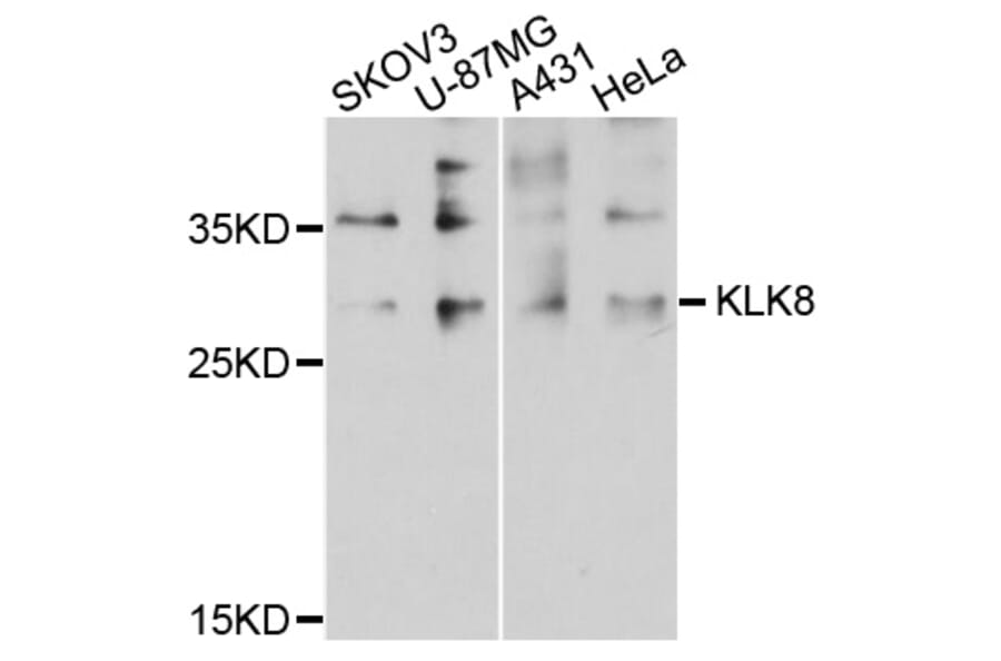 Western Blot - Anti-KLK8 Antibody (A8975) - Antibodies.com