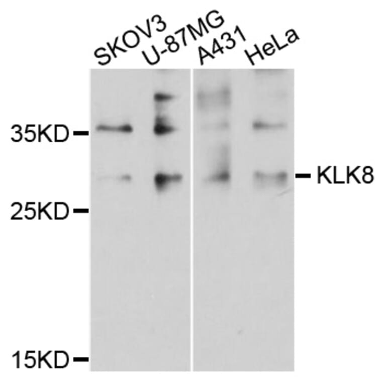 Western Blot - Anti-KLK8 Antibody (A8975) - Antibodies.com