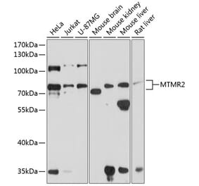 Western Blot - Anti-MTMR2 Antibody (A16280) - Antibodies.com