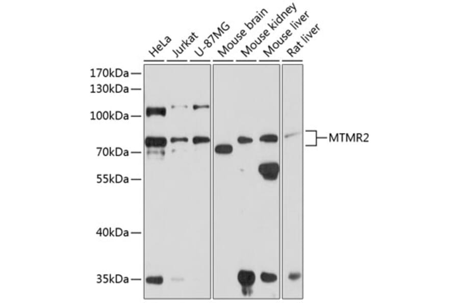 Western Blot - Anti-MTMR2 Antibody (A16280) - Antibodies.com