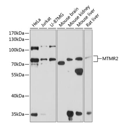 Western Blot - Anti-MTMR2 Antibody (A16280) - Antibodies.com