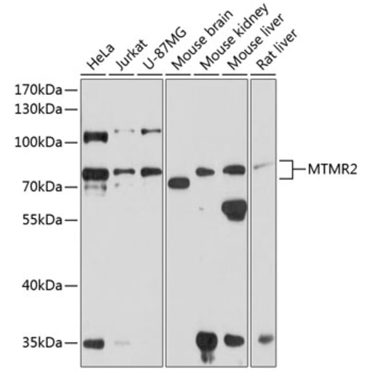 Western Blot - Anti-MTMR2 Antibody (A16280) - Antibodies.com