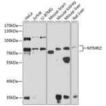 Western Blot - Anti-MTMR2 Antibody (A16280) - Antibodies.com