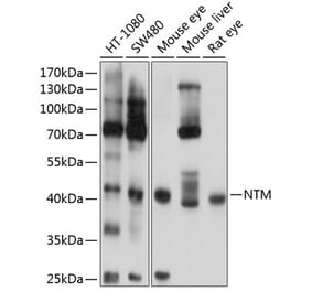 Western Blot - Anti-HNT Antibody (A16281) - Antibodies.com