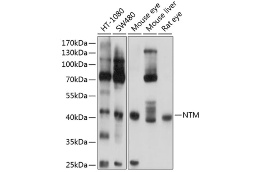 Western Blot - Anti-HNT Antibody (A16281) - Antibodies.com