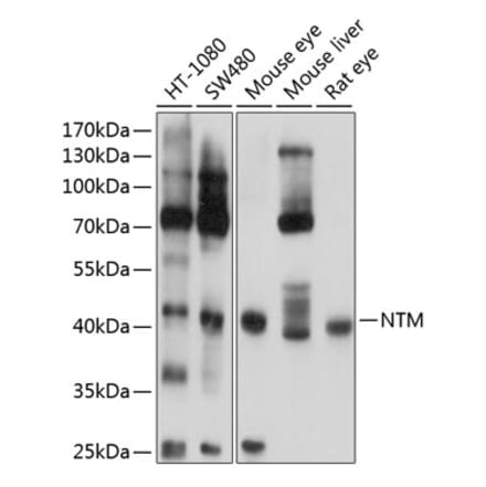 Western Blot - Anti-HNT Antibody (A16281) - Antibodies.com