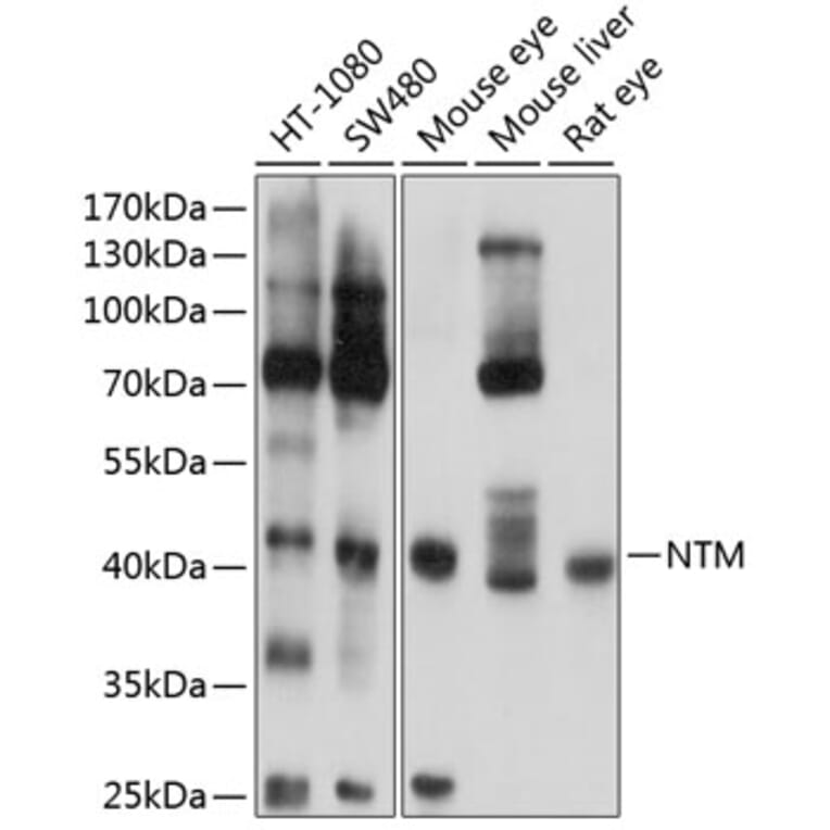 Western Blot - Anti-HNT Antibody (A16281) - Antibodies.com