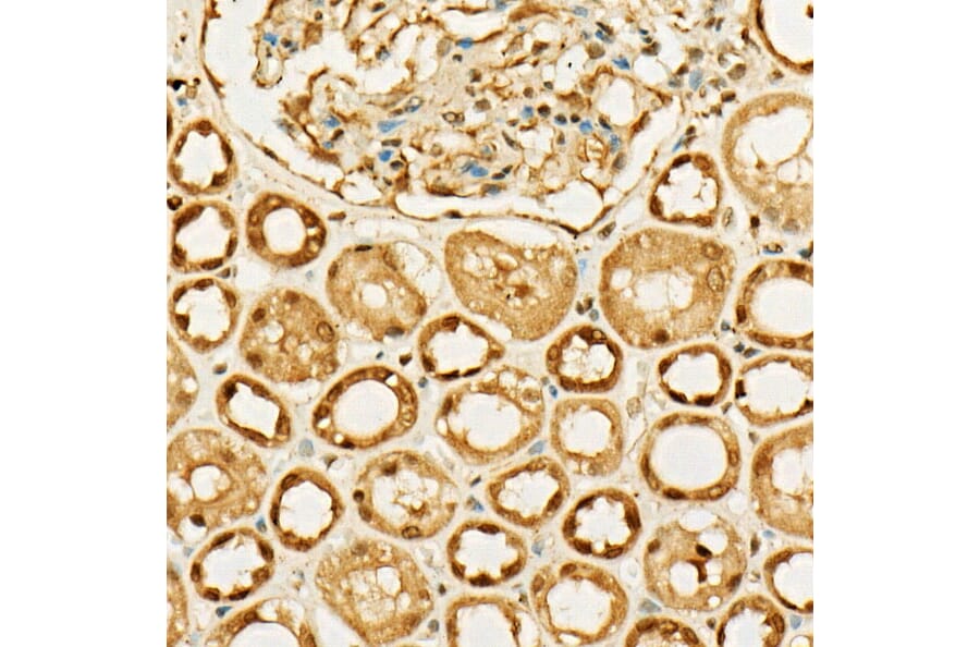 Immunohistochemistry - Anti-MGEA5/OGA Antibody (A16283) - Antibodies.com