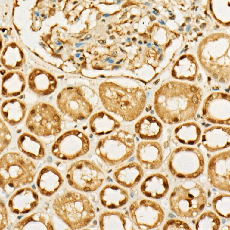Immunohistochemistry - Anti-MGEA5/OGA Antibody (A16283) - Antibodies.com