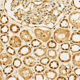 Immunohistochemistry - Anti-MGEA5/OGA Antibody (A16283) - Antibodies.com