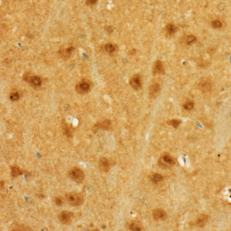 Immunohistochemistry - Anti-MGEA5/OGA Antibody (A16283) - Antibodies.com