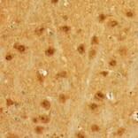 Immunohistochemistry - Anti-MGEA5/OGA Antibody (A16283) - Antibodies.com