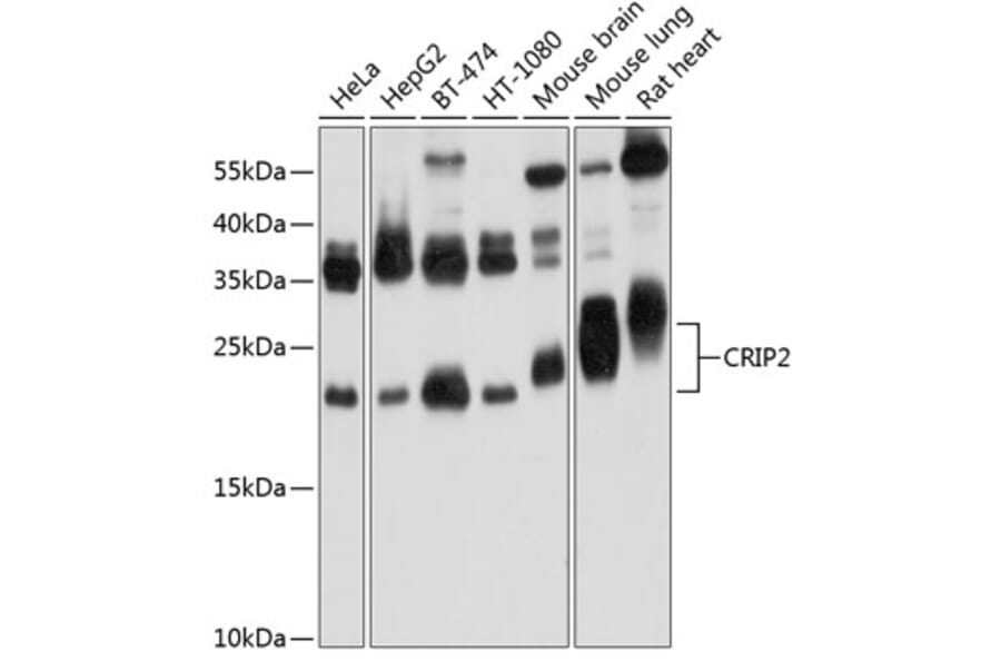 Western Blot - Anti-CRP-2 Antibody (A16284) - Antibodies.com