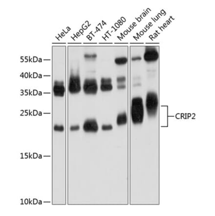 Western Blot - Anti-CRP-2 Antibody (A16284) - Antibodies.com