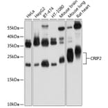 Western Blot - Anti-CRP-2 Antibody (A16284) - Antibodies.com