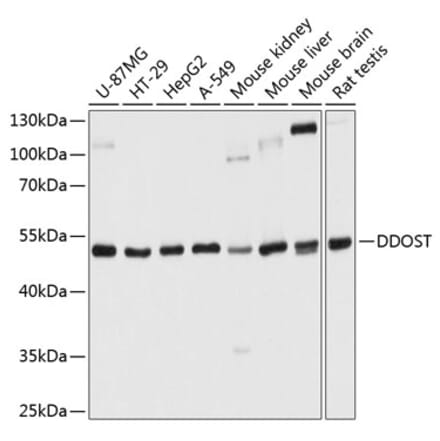 Western Blot - Anti-DDOST Antibody (A16286) - Antibodies.com