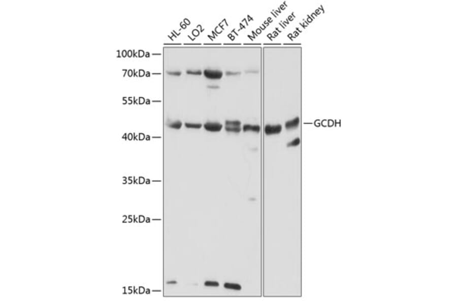 Western Blot - Anti-GCDH/GCD Antibody (A16287) - Antibodies.com