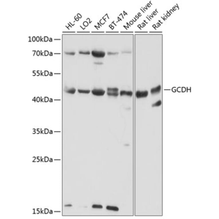 Western Blot - Anti-GCDH/GCD Antibody (A16287) - Antibodies.com