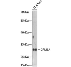 Western Blot - Anti-GPM6A Antibody (A16288) - Antibodies.com