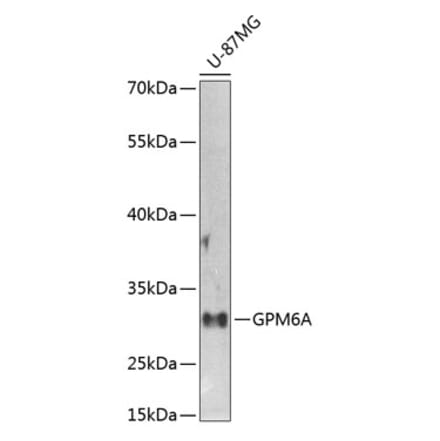 Western Blot - Anti-GPM6A Antibody (A16288) - Antibodies.com