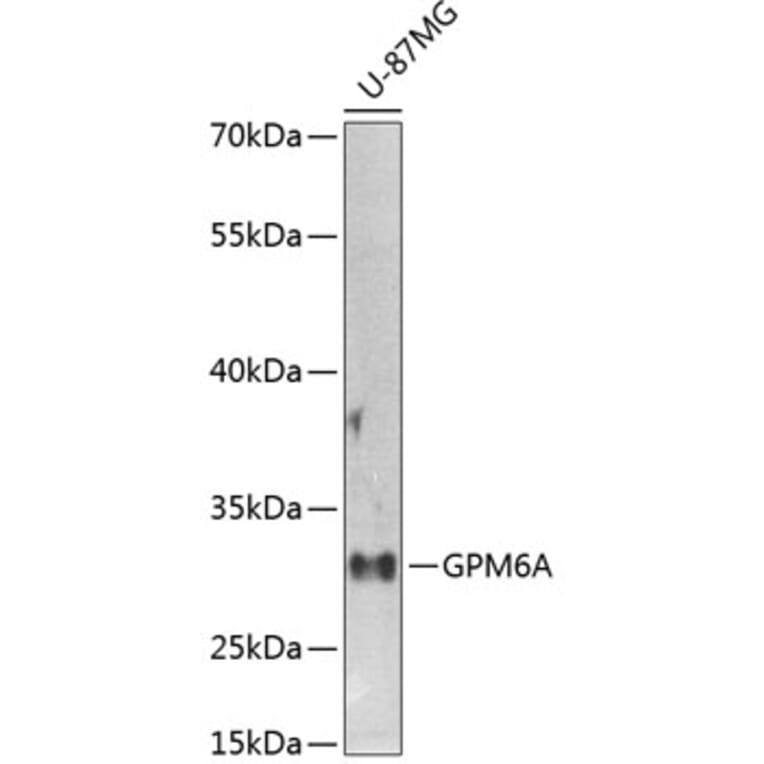 Western Blot - Anti-GPM6A Antibody (A16288) - Antibodies.com