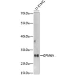 Western Blot - Anti-GPM6A Antibody (A16288) - Antibodies.com