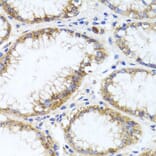 Immunohistochemistry - Anti-GPM6A Antibody (A16288) - Antibodies.com