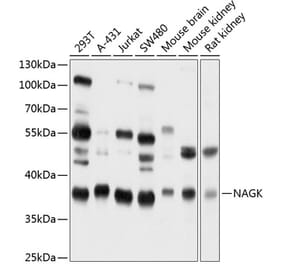 Western Blot - Anti-NAGK Antibody (A16289) - Antibodies.com